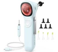 ScopeAround Otoscopio digitale con schermo IPS, 720p HD Smart Video otoscopio con luce, otoscopio auricolare con fotocamera per la rimozione del cerume, controllo dell'orecchio, Power On and Go (blu)