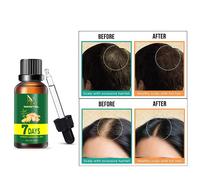 Scorri l'immagine per ingrandire Ginger Hair Growth Essence Germinal Hair Gro...