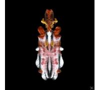 Scraps of Tape The Will to Burn (CD) Album Digipak