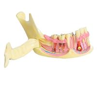 SdaryWare Modello di Denti della mascella Inferiore Dentale - Modello didattico per Lo Studio dei Denti dentali - Modello di decomposizione del Tessuto mandibolare mandibolare anatomico