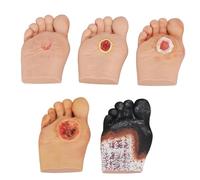 SdaryWare Modello di simulatore del Piede diabetico con lesioni purulente della ferita, Classi 1-5, per dimostrazioni di Anatomia, fisiologia e Cura delle ferite