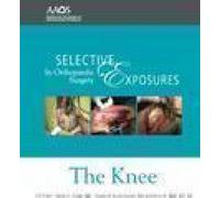 Selective Exposures in Orthopaedic Surgery: The Knee