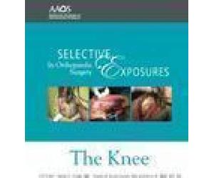 Selective Exposures in Orthopaedic Surgery: The Knee