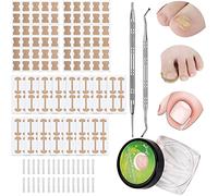 Set di 150 + 2 Strumenti per Unghie dei Piedi Incarniti, Includi, Patch Unghie Elastico Adesivi Curvi delle Unghie File dell'Unghia Incarnito e Adesivi Correzione dell'Unghia Piede Incarniti