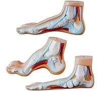 Set di 3 modelli di patologia dell'arco plantare umano, modello anatomico con piede normale, piatto e alto for l'insegnamento in aula medica
