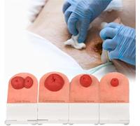 Set di modelli di addestramento for stomia, kit di addestramento for la cura della stomia da 4 pezzi, modelli for la cura delle ferite, modello di stomia fecale di simulazione da tavolo.