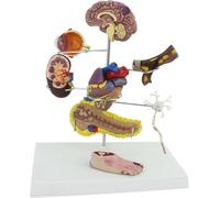 Set di modelli for il diabete da 8 pezzi, modello for il diabete | Replica for l'educazione all'anatomia umana e alla fisiologia, modello medico for la comunicazione