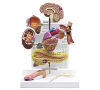 Set di modelli per diabete e ipertensione, confezione da 8 | Punti salienti dell'articolo: modelli di visualizzazione di malattie cerebrali, occhi, cuore, reni e piedi per l'educazione