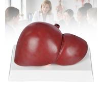 Set Modelli Anatomici del Fegato, 3 Modelli Patologici Scala 1:1,A | Confronta Fegato Normale, Fegato Grasso Non Alcolico e Alcolico per l’Insegnamento dell’Anatomia,A