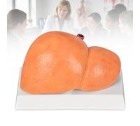 Set Modelli Anatomici del Fegato, 3 Modelli Patologici Scala 1:1,C | Confronta Fegato Normale, Fegato Grasso Non Alcolico e Alcolico per l’Insegnamento dell’Anatomia,C