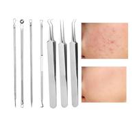 Sghtil Comedone - Kit estrattore a bottone, kit estrattore per naso popping 7x brufolo | Strumento popper per la pulizia dei pori in acciaio inossidabile per pulsanti