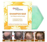 Shampoo bar antiforfora fatto a mano per sapone per la cura della crescita de...