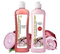 Shampoo e balsamo alla biotina di cipolla - Set shampoo e balsamo idratante per la crescita naturale dei capelli, shampoo per la crescita dei capelli alla biotina per tutti i tipi di capelli