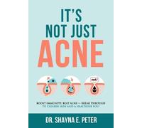 Shayna E Peter It's Not Just Acne (Tascabile)