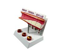 SheerFaring Modello Strutturale con | Struttura in PVC Resistente, Modello di Patologia Vascolare, Chiaro, per Aula Scolastica, Scuola, Insegnanti, Occlusione Vasale B