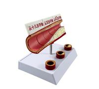SheerFaring Modello Strutturale con | Struttura in PVC Resistente, Modello di Patologia Vascolare, Chiaro, per Aula Scolastica, Scuola, Insegnanti, Occlusione
