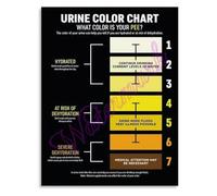 SHFTQXSLAT Occupational Heat Stress Poster Acclimatization Guidelines Water Rest Shade Protocol Training Wall-Art(Unframed,12x18inch(30x45cm))