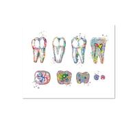 SHINERING Poster Su Tela Con Impianto Dentale, Corona Dentale, Anatomia Dei Denti, Immagini Artistiche Da Parete Mediche Per La Decorazione Della Clinica Dentale 21X30Cm Senza Telaio