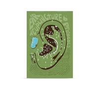 SHINERING Stampa Di Agopuntura Dell'Orecchio, Agopuntura Auricolare, Medicina Tradizionale Cinese, Poster Di Educazione Medica Sull'Anatomia Dell'Orecchio Stampa Su Tela A3 50Cmx70Cm Senza Telaio