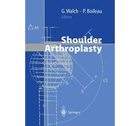 Shoulder Arthroplasty
