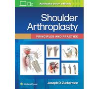 Shoulder Arthroplasty: Principles and Practice