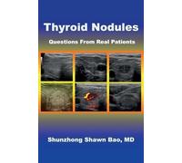 Shunzhong Shawn Bao Thyroid Nodules (Tascabile)