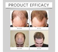 Siero anti-grigio Nuvilo per uomo, essenza di capelli e barba con Arcolys e Melano Grey, ripristina i pigmenti, rafforza le radici e favorisce capelli più scuri e sani (4 pezzi)