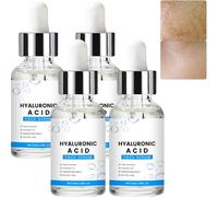Siero di acido ialuronico per il viso con vitamina C, leviga le rughe e le linee sottili, anti-invecchiamento siero schiarente, idratante idratante rimpolpante rassodante (4 pezzi)