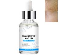 Siero di acido ialuronico per il viso con vitamina C, leviga le rughe e le linee sottili, anti-invecchiamento siero schiarente, idratante idratante rimpolpante rassodante (1 pezzi)