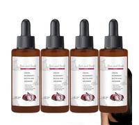 Siero per la crescita dei capelli con cipolla e rosmarino, siero per il cuoio capelluto, spray per la crescita dei capelli per donne con formula leggera, sieri nutrienti per il cuoio capelluto. 4