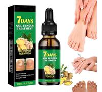 Siero per la crescita delle unghie allo zenzero, trattamento per unghie allo zenzero, supporto per unghie per la cura delle unghie, siero per il trattamento delle unghie 7 giorni, olio nutriente per