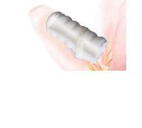 SINI-MEDIK Niederreiter Gmbh TAMPONE VAGINALE PER L'INCONTINENZA FEMMINILE CONTAM MED LARGE 33X61 MM 5 PEZZI