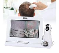 Sistema professionale di analisi del cuoio capelluto Microscopio rilevatore di peli Schermo HD da 11 pollici Nessuna app necessaria Sonda con ingrandimento 50X/200X