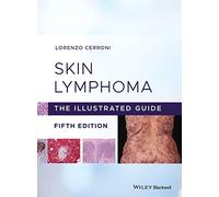 Skin Lymphoma: The Illustrated Guide