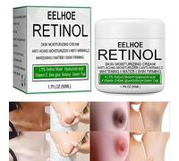Skin Whitening Cream for Dark Skin,Skin Lightening Cream-Underarm Whitening Cream,Underarm Armpit Whitening Cream,Armpit Whitening Cream,Skin Lightening Cream,Underarm Whitening Cream (1pcs,50ML)