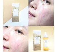 SKIN1004 Madagascar Centella Ampolle 100 ml Moisture Calming Acne Blemish Care