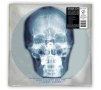 Skull X-Ray