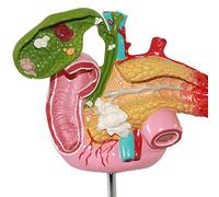 SLRMKK Anatomia Umana Modelli scientifici-Visceri Modello patologico Duodeno pancreatico Patologia della colecisti Modello dell'apparato digerente per Classe di scienze