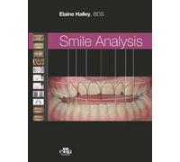 Smile analysis. Ediz. italiana