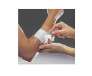 Smith & Nephew FILM ADESIVO IN POLIURETANO IN ROTOLO TRASPARENTE IMPERMEABILE PER FISSAGGIO DI MEDICAZIONI E CATETERI 5X1000 1MED
