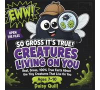 So Gross It's True! Creatures Living On You: Real, Gross, 100% True Facts About the Tiny Creatures That Live On You (A Gross Science Book for Kids Ages 7-10): 3