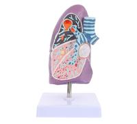 SOIMISS Modello Anatomico Polmonare Realistico in Plastico per Insegnamento della Fisiologia e Anatomia, Modello Didattico per Studenti Dettagli Patologici e Sezioni Visibili