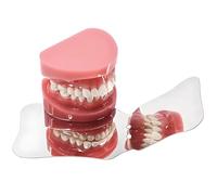 Specchio per fotografia dentale in acciaio inossidabile, riflettore orale per uso ortodontico, strumento professionale per l'esame dei denti(A)