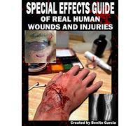 Benito Garcia Special Effects Guide Of Real Human Wounds and Injurie (Tascabile)