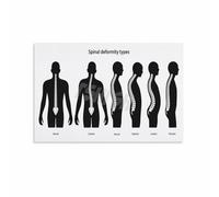 Spine Anatomy Poster Human Vertebrae Chart Canvas Wall Art for Chiropractic Office Decor Physical Therapy Clinic(Unframed,12x18inch(30x45cm))