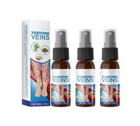Spray Curativo per Vene Varicose, Spray Miracoloso Anti Varicose Biologico, Spray per Vene Varicose per Gambe, Migliora Laspetto Della Gamba, Trattamento Lenitivo per Le Vene Varicose