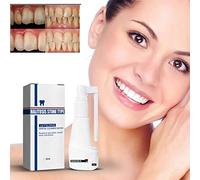 Spray dentale dissolvente senza calcoli, Spray rinfrescante per la bocca, Detergente per denti per rimuovere il tartaro, Dentifricio intensivo per la rimozione delle macchie (1 pz)