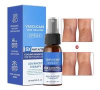 Spray per le Gambe,30ml Spray Massaggio Lenitivo Per Gambe | Soluzione dal Disagio delle Vene,per Casa, Salon, Notturno, Viaggio, Postpartum, Persone Obese e Post Esercizio