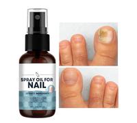 Spray Riparaunghie - Lozione Rinforzante Unghie 30ml - Cura Unghie Mani e Piedi per Salone Casa Viaggio Notte Pelle Sensibile Pedicure Manicure