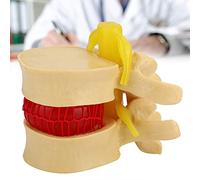 Srliya Modello della Colonna Vertebrale con Struttura Lombare e Scala 1,5x | Materiale elastomero morbido, Strumento didattico clinico, Adatto per ortopedia, Rappresentazione accurata del disco